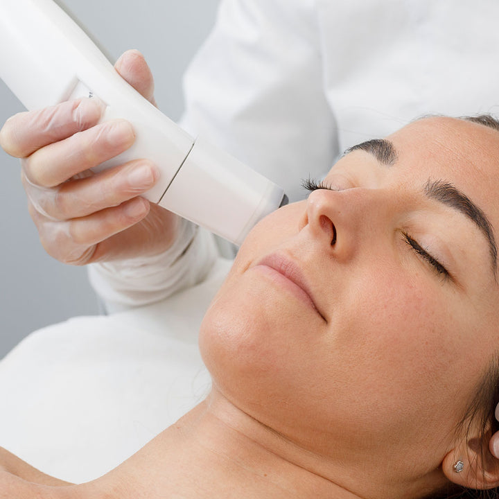 Radiofrecuencia facial