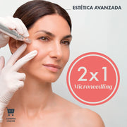 Microneedling mesoestetic® por solo 49€ (Shop.app)