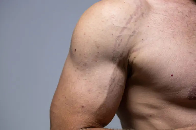 ¿Para qué sirve el gel de Polinucleótidos?