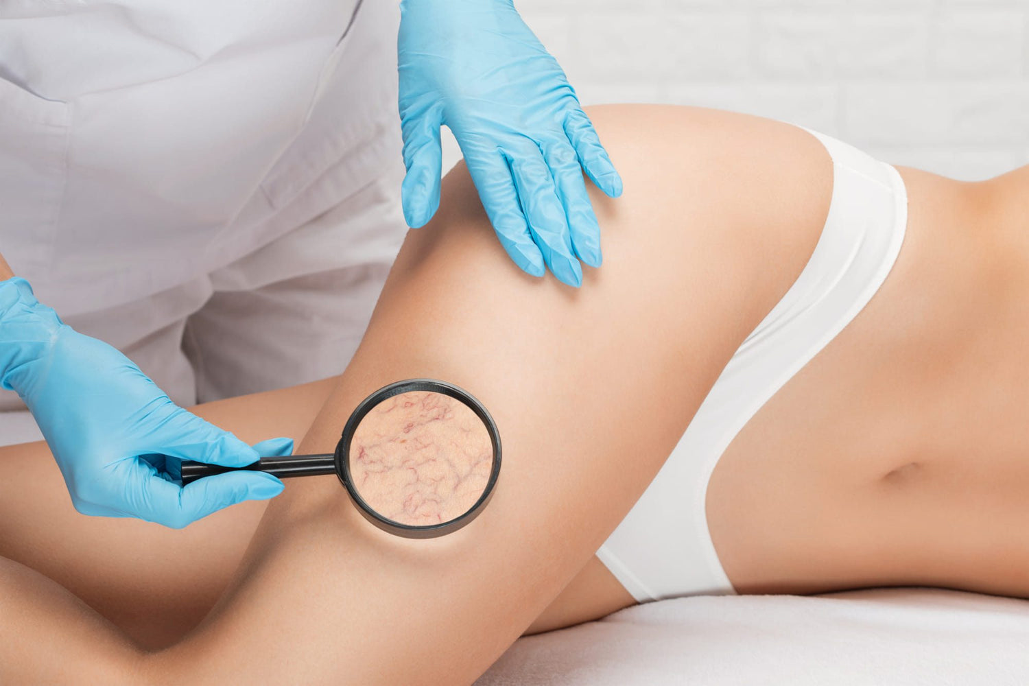Escleroterapia en Alcalá de Henares