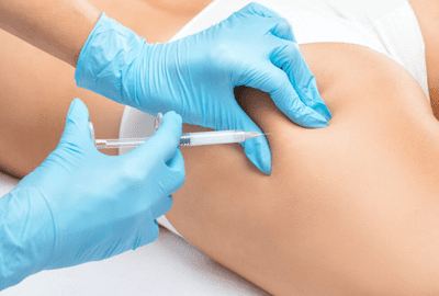 mesoterapia